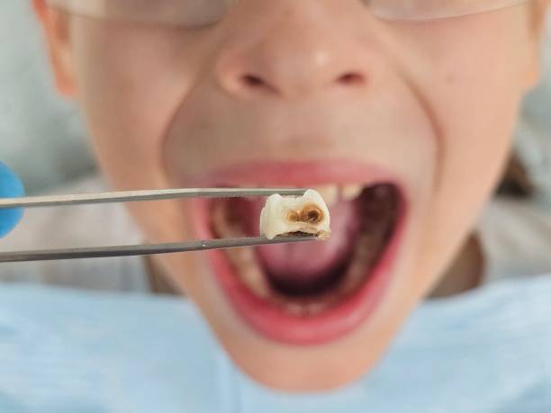 Best Emergency Dentist for Special Needs Patients in Montara, CA